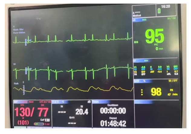 fortune-biomass-feedstock