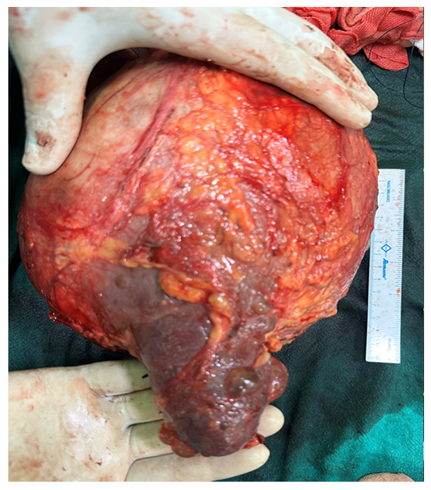 fortune-biomass-feedstock