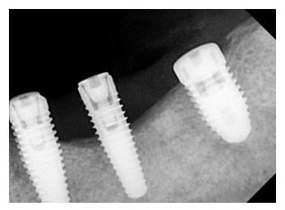 fortune-biomass-feedstock