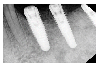 fortune-biomass-feedstock