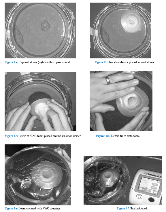 fortune-biomass-feedstock