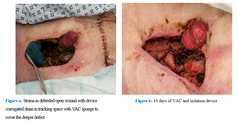 fortune-biomass-feedstock