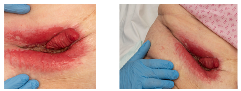 fortune-biomass-feedstock