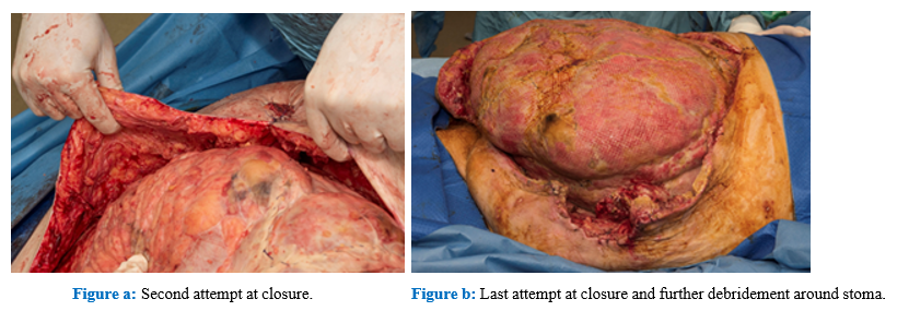 fortune-biomass-feedstock