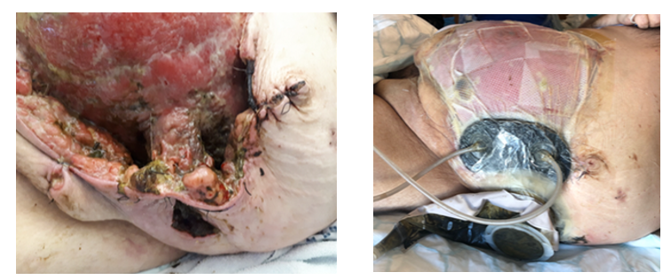 fortune-biomass-feedstock