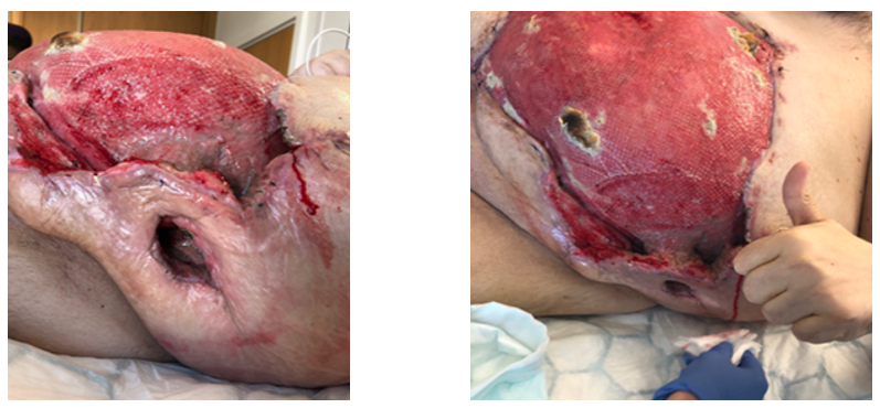 fortune-biomass-feedstock