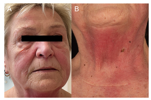 fortune-biomass-feedstock fortune-biomass-feedstock