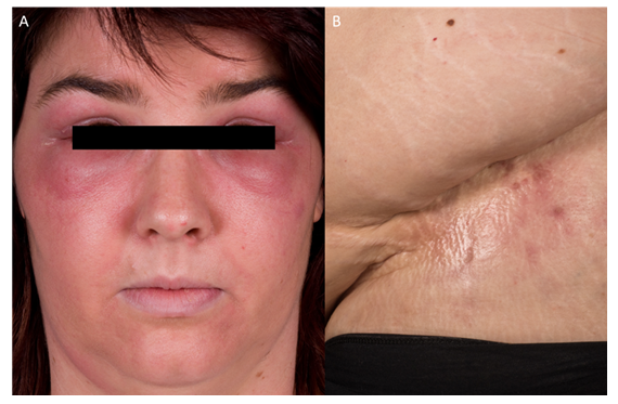 fortune-biomass-feedstock fortune-biomass-feedstock