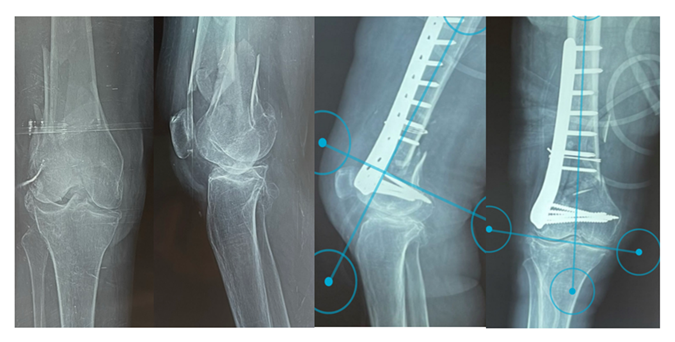 fortune-biomass-feedstock