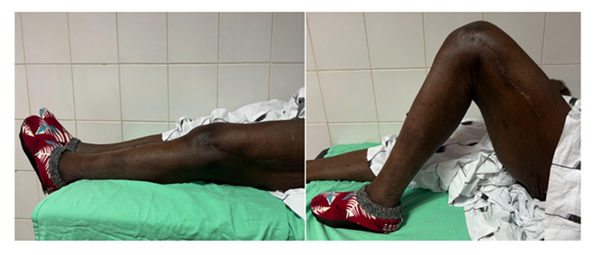 fortune-biomass-feedstock