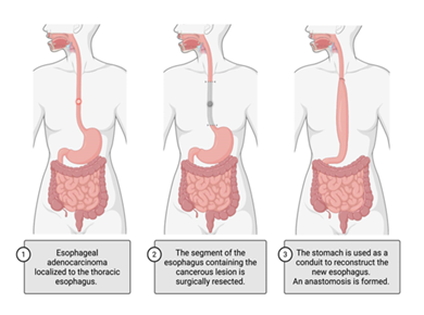 fortune-biomass-feedstock