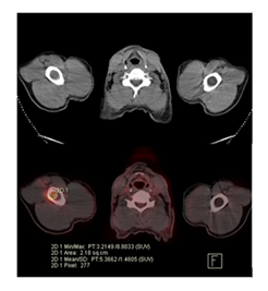 fortune-biomass-feedstock