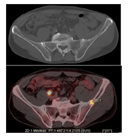 fortune-biomass-feedstock