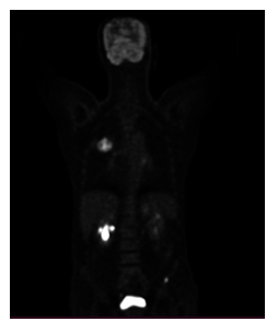 fortune-biomass-feedstock