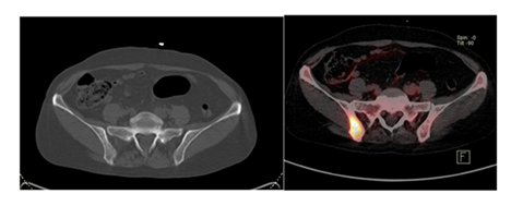 fortune-biomass-feedstock