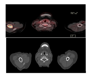 fortune-biomass-feedstock