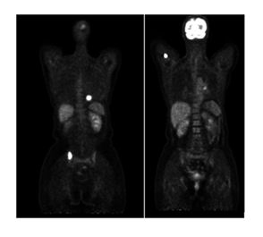 fortune-biomass-feedstock