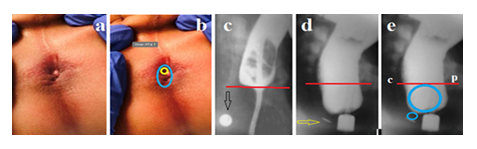 fortune-biomass-feedstock fortune-biomass-feedstock