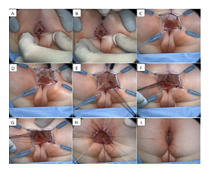 fortune-biomass-feedstock fortune-biomass-feedstock