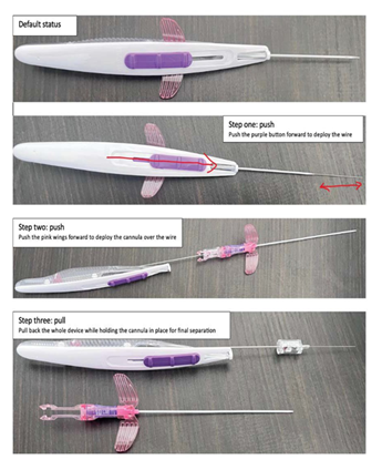 fortune-biomass-feedstock